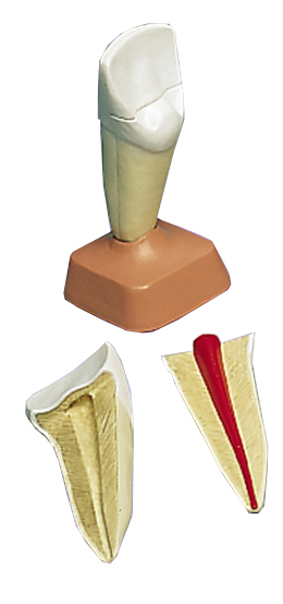 进口上颌切齿模型(2部分)-德国3B-VE300